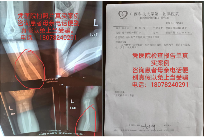 苗山中草药医师马杰彬40年行医路 心脑血管疾病治疗新突破(图11)